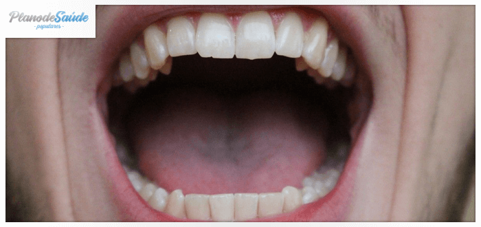 Homem com boca aberta - amígdalas